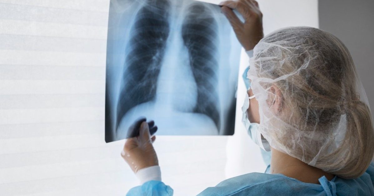Radiografías «deepfake»: la inteligencia artificial amenaza la fiabilidad de los diagnósticos, CostaCx
